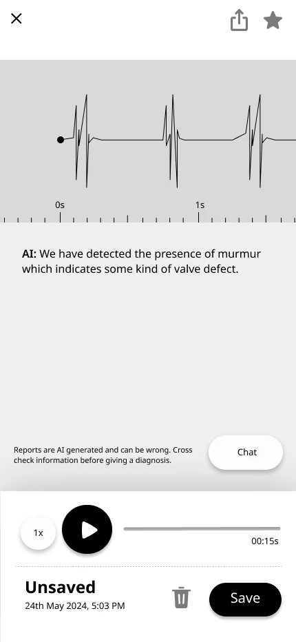 UI 2.0 result: a waveform with an AI sentence about a murmur