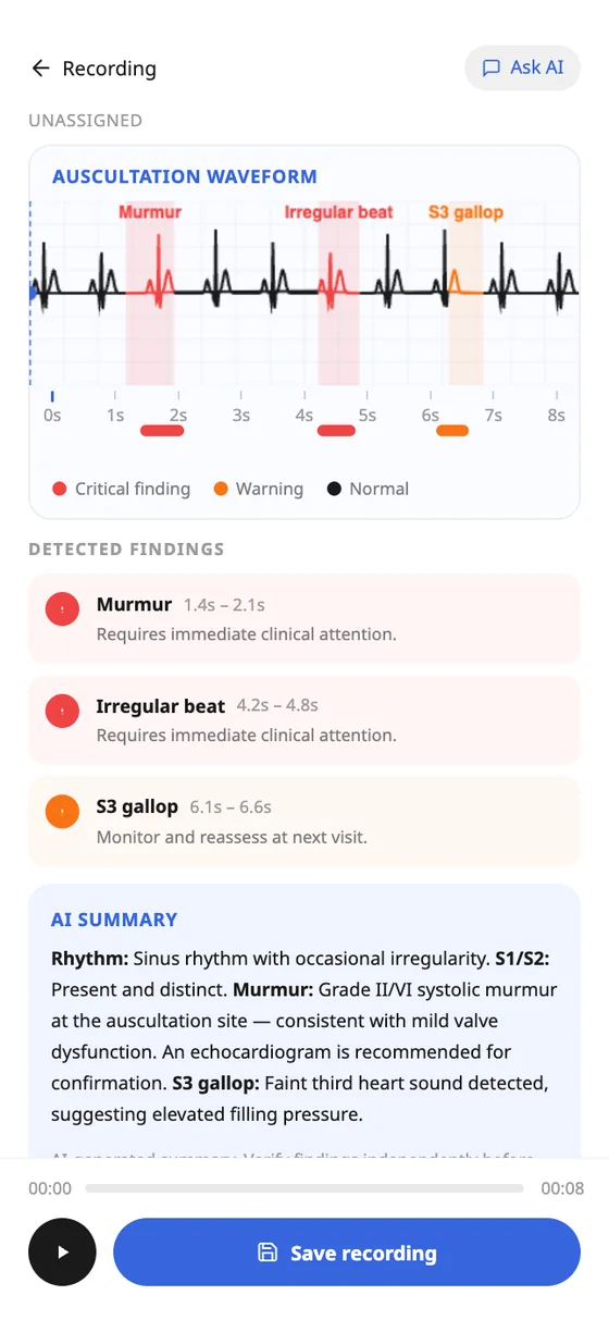 The AI report: findings named on the waveform with severity and a summary