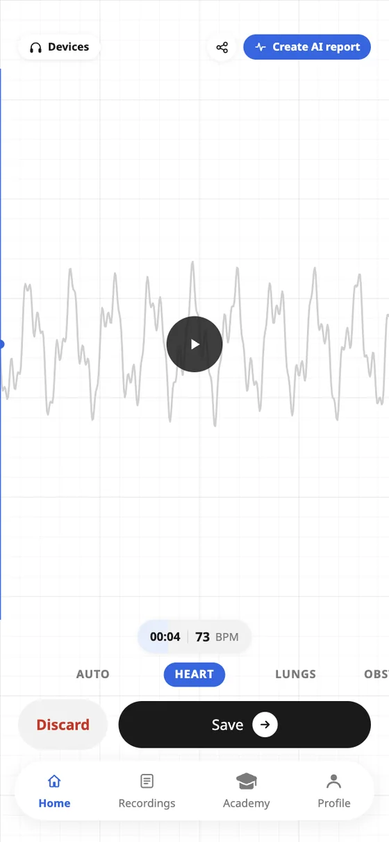 Final design: a finished recording with a Create AI report button